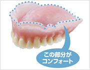 コンフォート義歯